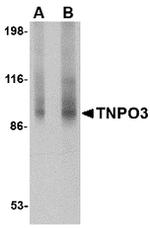 TNPO3 Antibody in Western Blot (WB)
