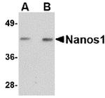 NANOS1 Antibody in Western Blot (WB)