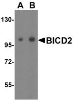 BICD2 Polyclonal Antibody