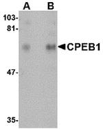 CPEB1 Polyclonal Antibody