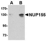NUP155 Polyclonal Antibody