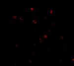 NUP160 Polyclonal Antibody