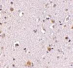 NUP160 Antibody in Immunohistochemistry (IHC)