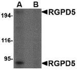 RGPD5 Polyclonal Antibody