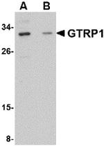 GRTP1 Polyclonal Antibody