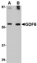 GDF6 Polyclonal Antibody