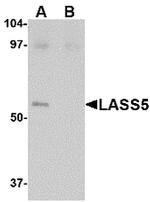 Lass5 Antibody in Western Blot (WB)