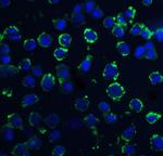 DNAL1 Polyclonal Antibody