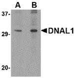 DNAL1 Antibody in Western Blot (WB)