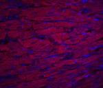 ASAH1 Antibody in Immunohistochemistry (IHC)