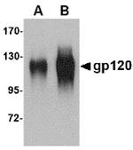 HIV1 gp120 Polyclonal Antibody