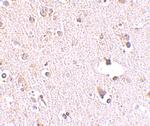 POLR3F Polyclonal Antibody