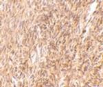 TRIM30 Antibody in Immunohistochemistry (IHC)