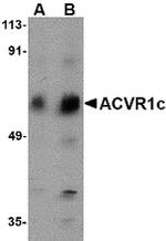 ACVR1C Polyclonal Antibody