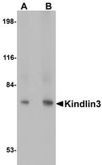 Kindlin 3 Polyclonal Antibody
