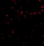 ITGA4 Polyclonal Antibody