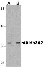 ALDH3A2 Polyclonal Antibody