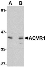 ACVR1 Polyclonal Antibody