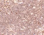 S1P1 Antibody in Immunohistochemistry (IHC)