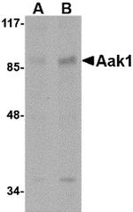 AAK1 Polyclonal Antibody