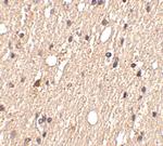 SPRED1 Polyclonal Antibody