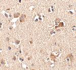 AIPL1 Polyclonal Antibody