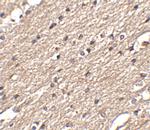 SPRED3 Polyclonal Antibody