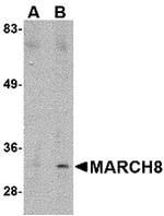 MARCH8 Antibody in Western Blot (WB)