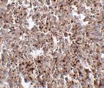 METTL7B Polyclonal Antibody