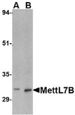 METTL7B Antibody in Western Blot (WB)