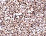 METTL7B Polyclonal Antibody