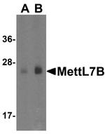 METTL7B Antibody in Western Blot (WB)