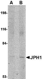 JPH1 Antibody in Western Blot (WB)