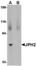 JPH2 Polyclonal Antibody