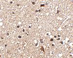 JPH3 Antibody in Immunohistochemistry (IHC)