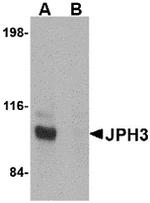 JPH3 Antibody in Western Blot (WB)
