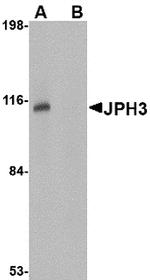 JPH3 Antibody in Western Blot (WB)