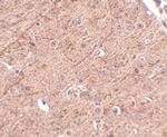 Lass5 Polyclonal Antibody