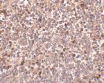 PIGY Antibody in Immunohistochemistry (IHC)