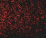 PIGY Antibody in Immunohistochemistry (IHC)