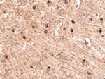 TOM70 Polyclonal Antibody