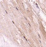 GBAS Antibody in Immunohistochemistry (IHC)