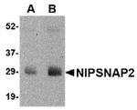 GBAS Antibody in Western Blot (WB)