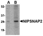 GBAS Antibody in Western Blot (WB)
