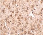 NIPSNAP3A Antibody in Immunohistochemistry (IHC)