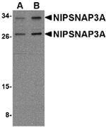NIPSNAP3A Antibody in Western Blot (WB)