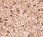 NIPSNAP3B Polyclonal Antibody