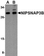 NIPSNAP3B Antibody in Western Blot (WB)