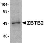 ZBTB2 Polyclonal Antibody