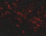 GLE1 Antibody in Immunohistochemistry (IHC)